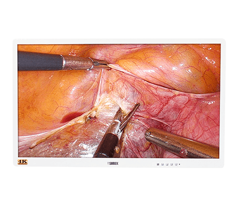 4K UHD Medical Endoscope Monitor 55”
