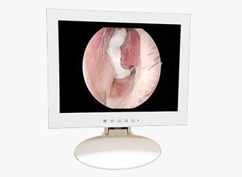 Medical Endoscope Monitor 15＂