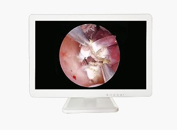 Medical HD Endoscope Monitor 21＂