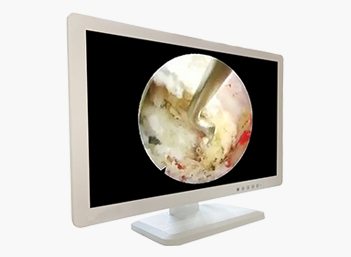 Medical FHD Endoscope Monitor 24＂
