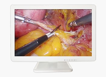 Medical FHD Endoscope Monitor 27＂