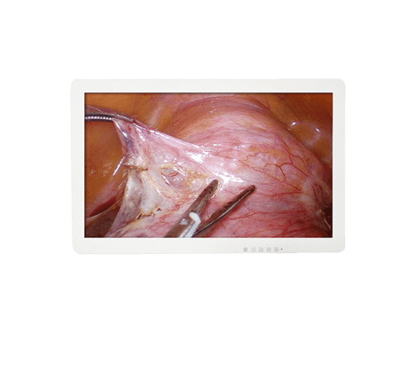 3D Medical Endoscope Monitor 32＂