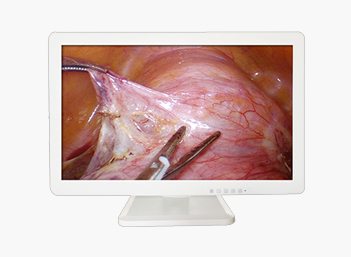 3D Medical Endoscope Monitor 32＂
