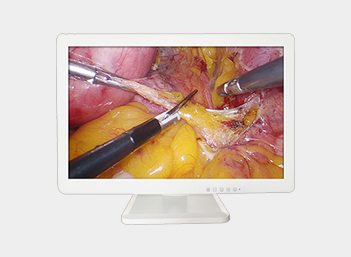 4K UHD Medical Endoscope Monitor 43＂